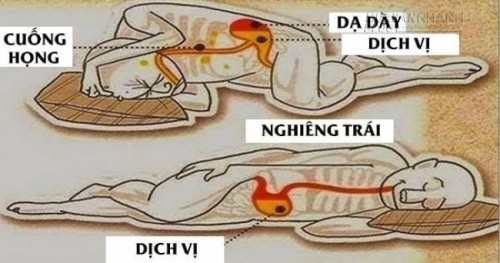 Tư thế nằm ngửa có thể gây nguy hiểm cho những người mắc các chứng bệnh liên quan đến hô hấp như bị ngưng thở khi ngủ, thở gấp hoặc hen suyễn. Tư thế ngủ nghiêng bên phải thì gây ảnh hưởng nghiêm trọng đến các bệnh đường tiêu hoá. Vậy còn tư thế nằm nghiêng bên trái thì sao?