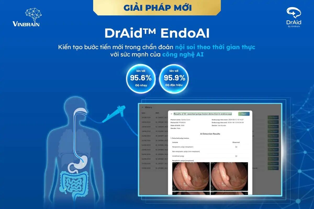 VinBrain trình làng DrAid EndoAI: “Đôi mắt thứ ba” siêu việt